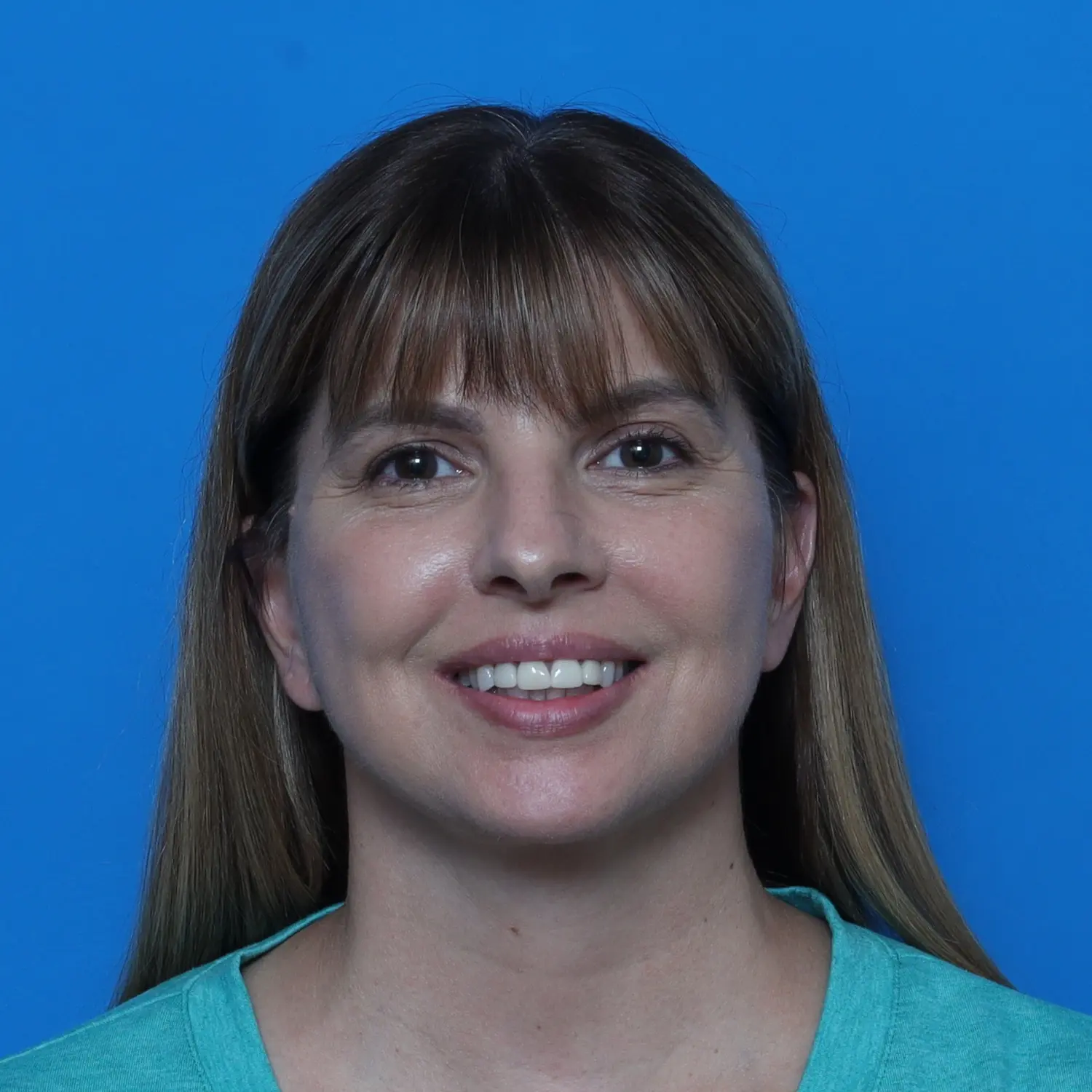 Facelift Patient Photo - Case 10768 - after view-1