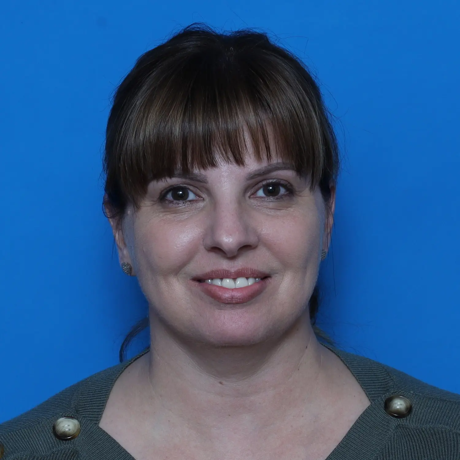 Facelift Patient Photo - Case 10768 - before view-1