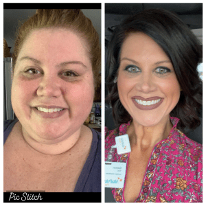 Patient Rebekah before (left) vs. after (right) her weight loss journey and post weight loss cosmetic surgery
