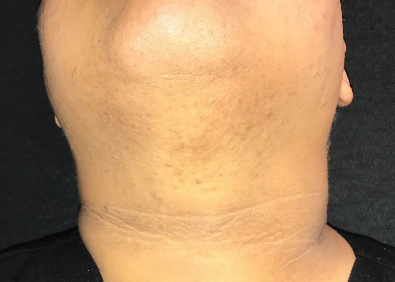 Case 11480 - After