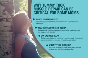 Why Tummy Tuck Muscle Repair Can Be Critical For Some Moms [Infographic]