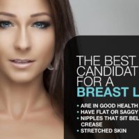 The Best Candidates For A Breast Lift [Infographic]