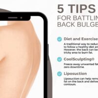 5 Tips for Battling Back Bulge [Infographic]