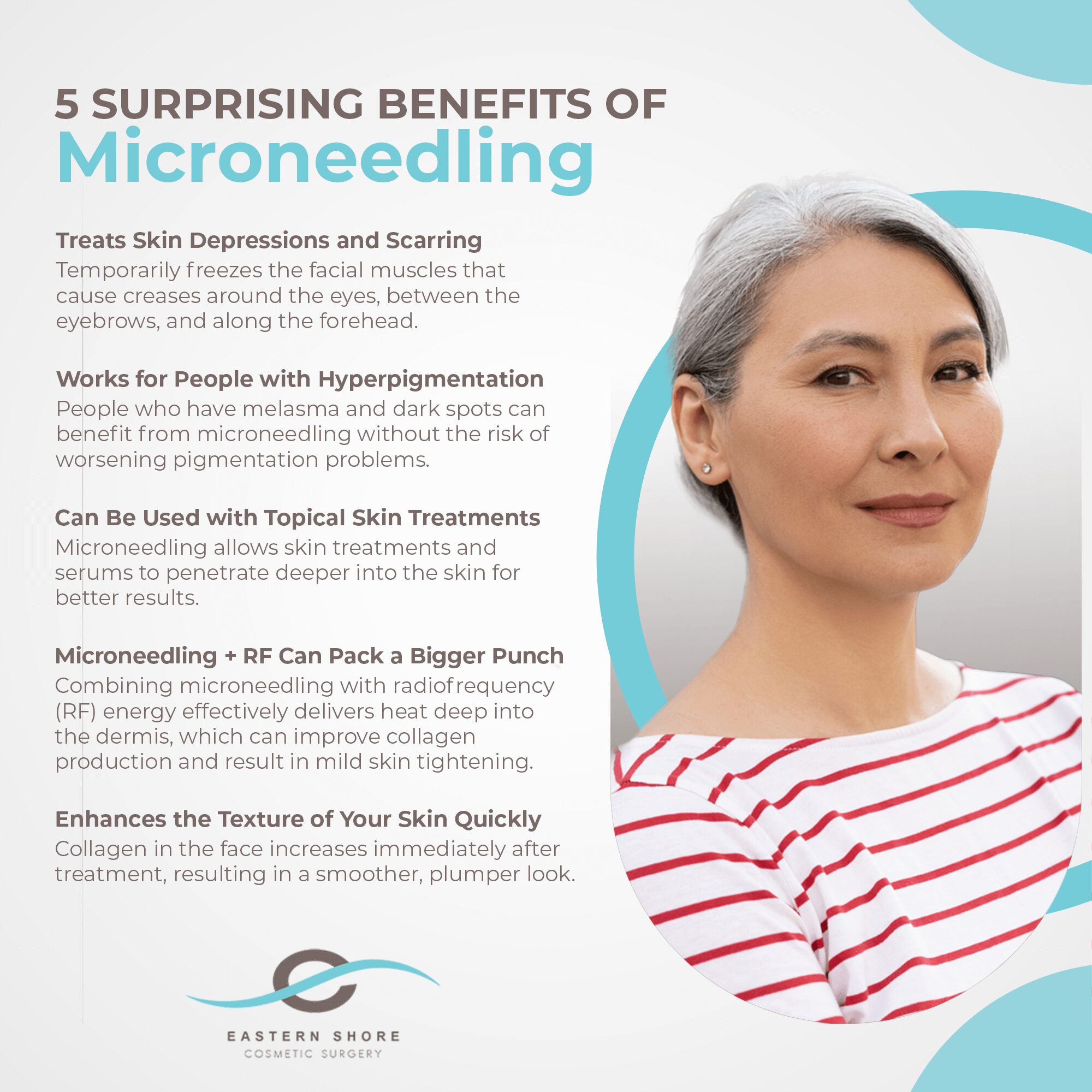 5 Surprising Benefits of Microneedling